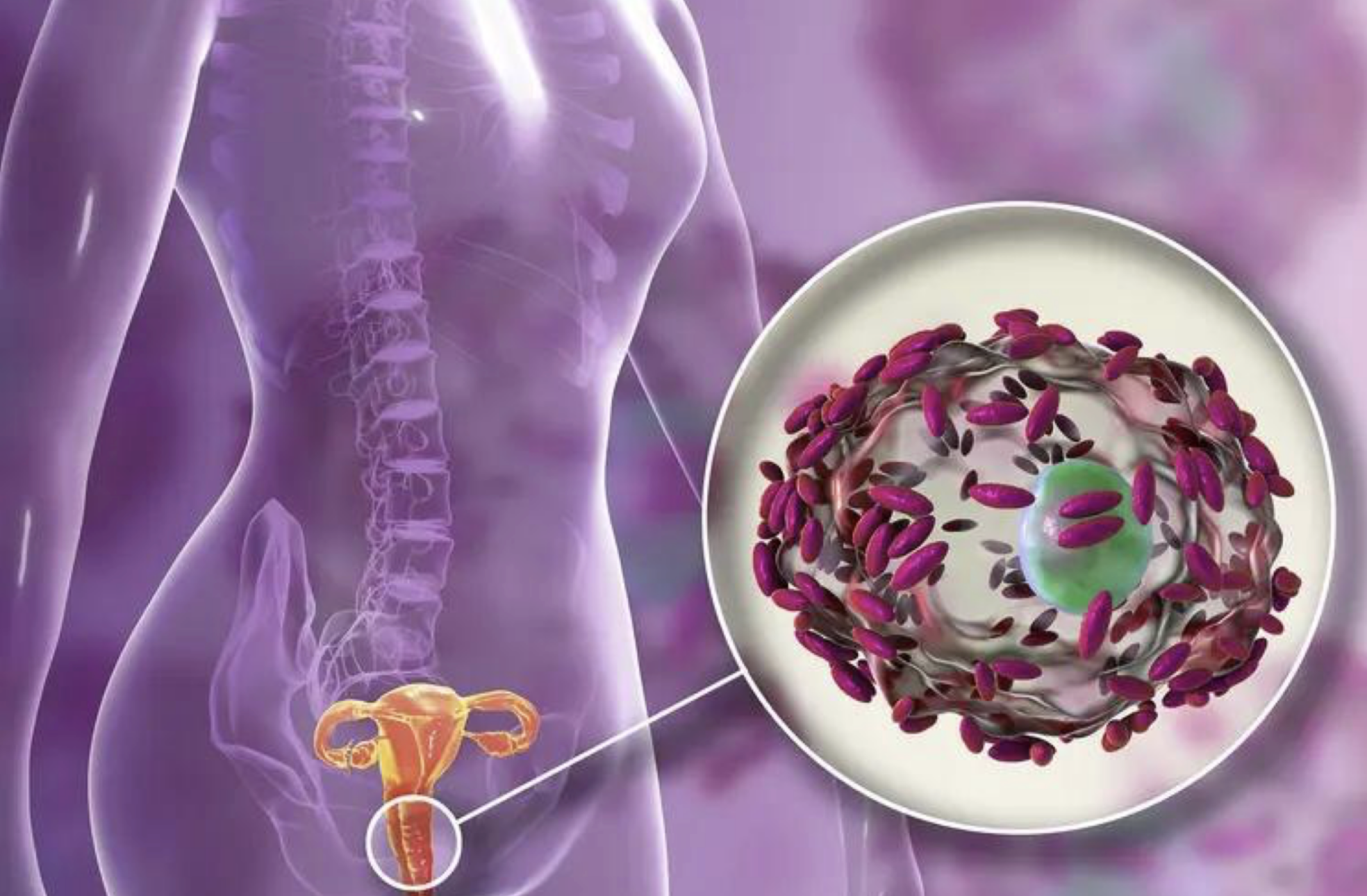 Diagram of female reproductive system with magnified biofilm view