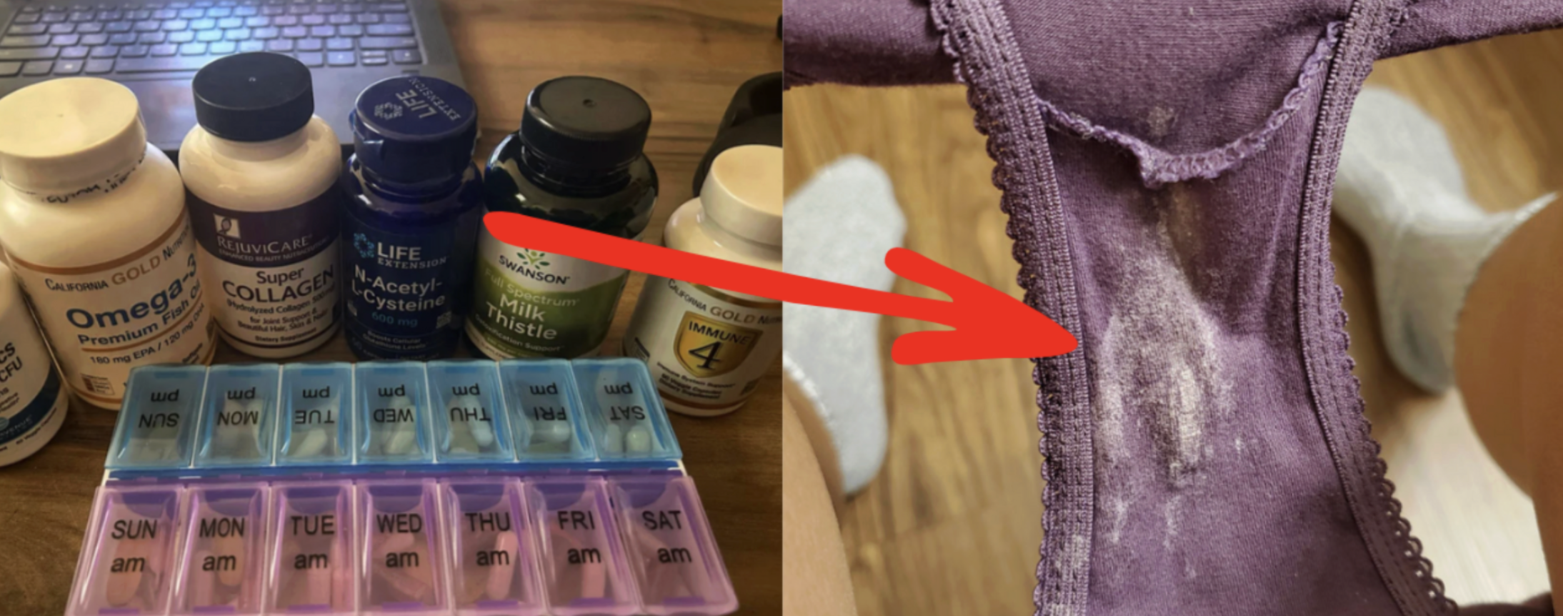 Supplement bottles and weekly pill organizer next to purple underwear with white discharge